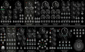 Erica Black System II