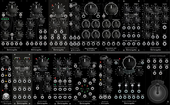 Erica Black System II (copied from OakhavenModular)